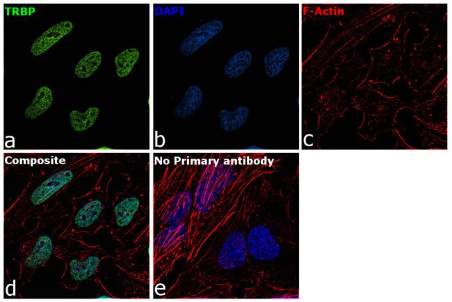 TRBP Antibody in Immunocytochemistry (ICC/IF)