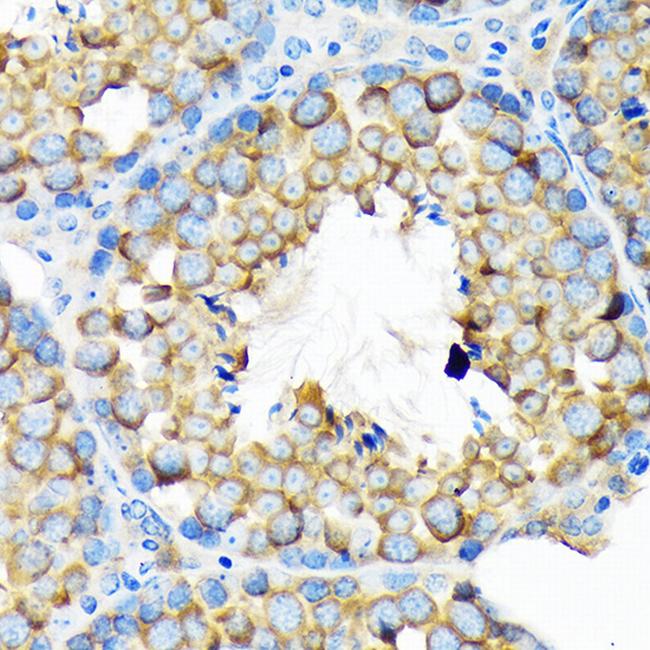 ALDH1A2 Antibody in Immunohistochemistry (Paraffin) (IHC (P))