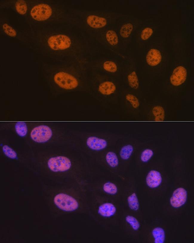 PTBP2 Antibody in Immunocytochemistry (ICC/IF)