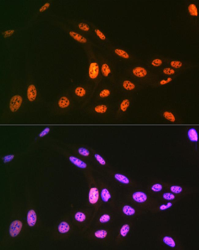 PRP19 Antibody in Immunocytochemistry (ICC/IF)