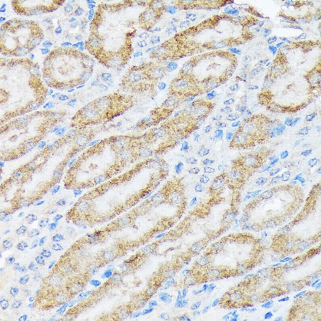 TIRAP Antibody in Immunohistochemistry (Paraffin) (IHC (P))