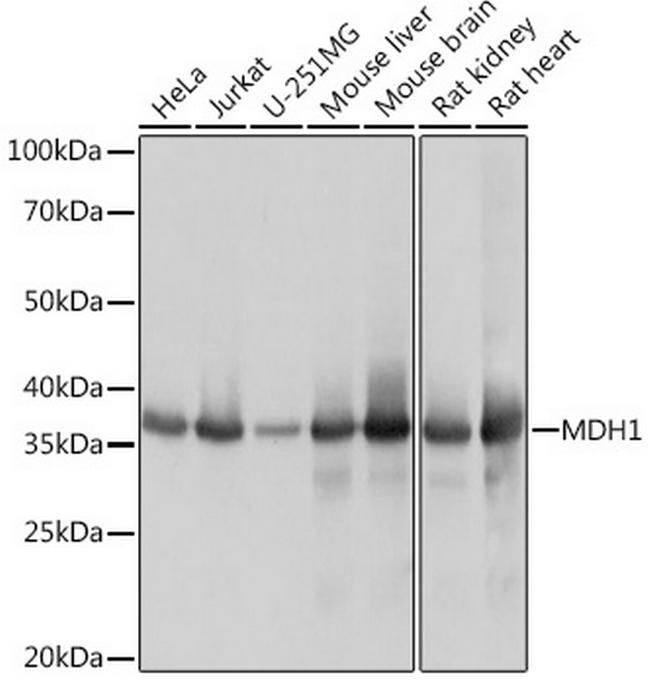 MDH1 Antibody in Western Blot (WB)