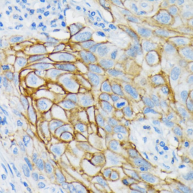 GluR6 Antibody in Immunohistochemistry (Paraffin) (IHC (P))