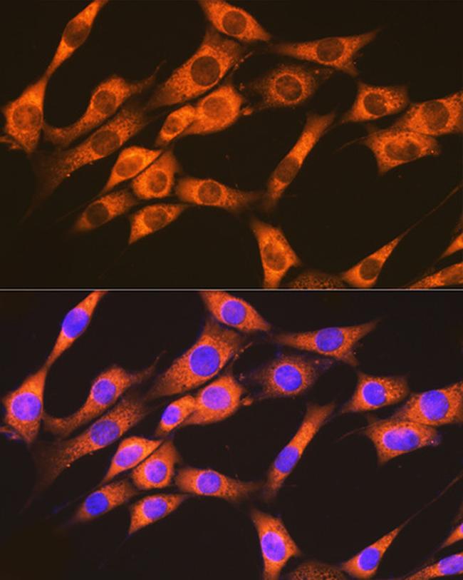 RAP1A/RAP1B Antibody in Immunocytochemistry (ICC/IF)