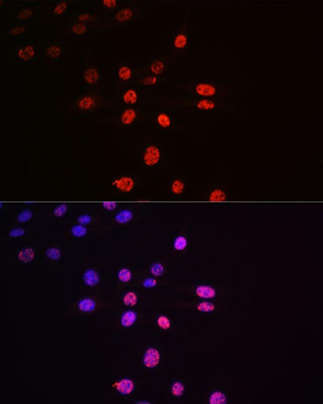 Phospho-p70 S6 Kinase (Thr421) Antibody in Immunocytochemistry (ICC/IF)