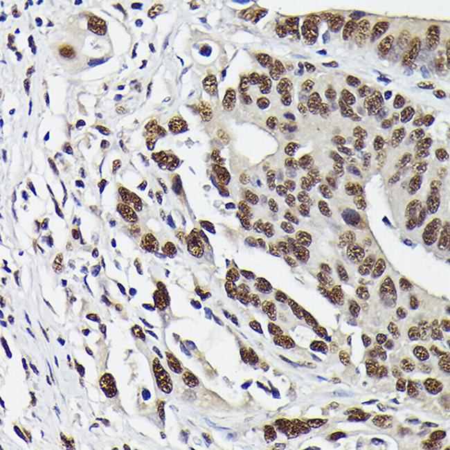 Phospho-SMAD3 (Ser423) Antibody in Immunohistochemistry (Paraffin) (IHC (P))