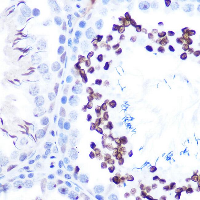 Phospho-STAT1 (Ser727) Antibody in Immunohistochemistry (Paraffin) (IHC (P))