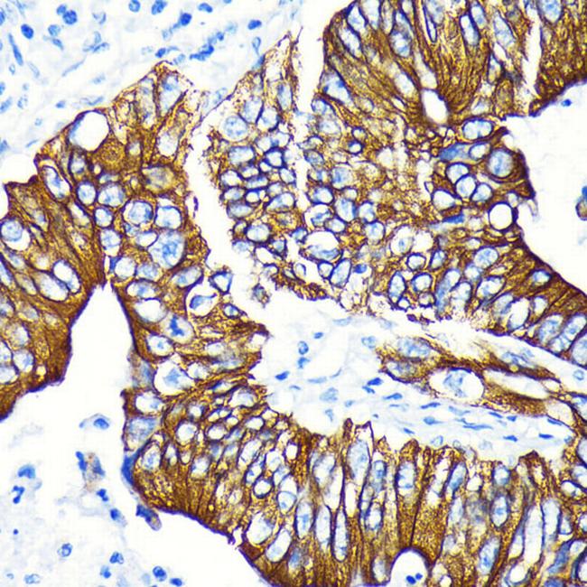 Phospho-GSK3B (Ser9) Antibody in Immunohistochemistry (Paraffin) (IHC (P))