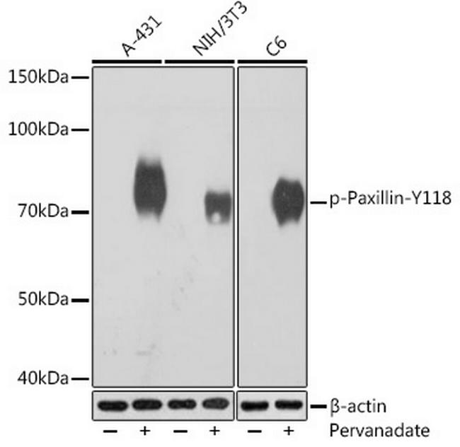 Phospho-Paxillin (Tyr118) Antibody in Western Blot (WB)