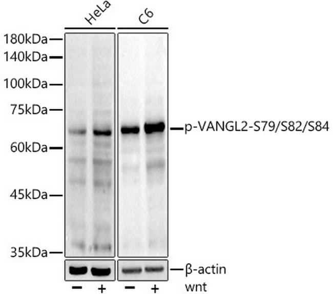 Phospho-VANGL2 (Ser79, Ser82, Ser84) Antibody in Western Blot (WB)