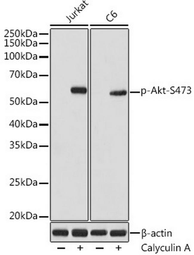 Phospho-AKT1/AKT2/AKT3 (Ser473) Antibody in Western Blot (WB)