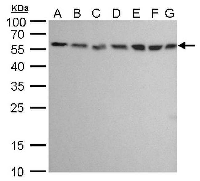 ATG12 Antibody in Western Blot (WB)