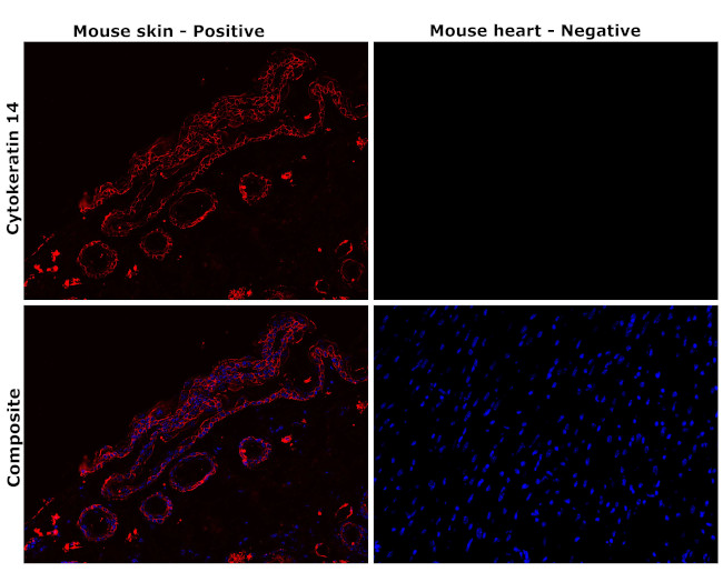 Cytokeratin 14 Antibody in Immunohistochemistry (Paraffin) (IHC (P))