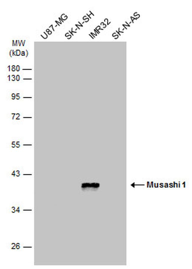 MSI1 Antibody in Western Blot (WB)