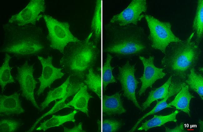 PKM Antibody in Immunocytochemistry (ICC/IF)