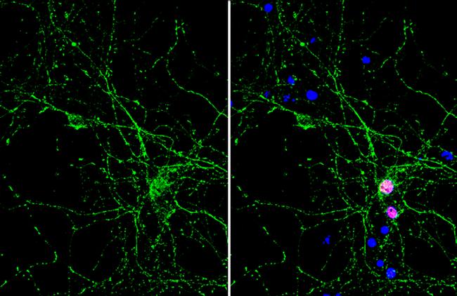 PGP9.5 Antibody in Immunocytochemistry (ICC/IF)