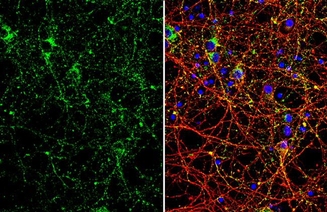 VAMP2 Antibody in Immunocytochemistry (ICC/IF)