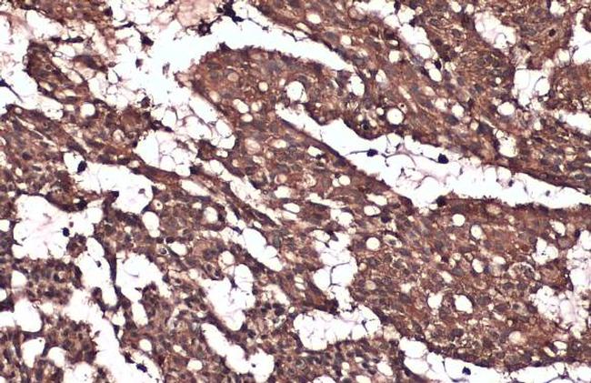 IKK beta Antibody in Immunohistochemistry (Paraffin) (IHC (P))