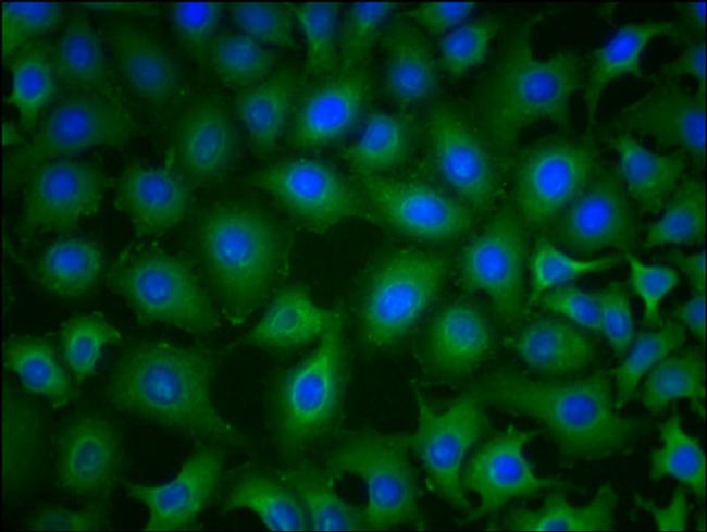 PKM Antibody in Immunocytochemistry (ICC/IF)