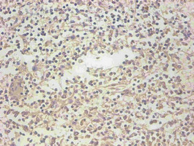 NGAL Antibody in Immunohistochemistry (Paraffin) (IHC (P))