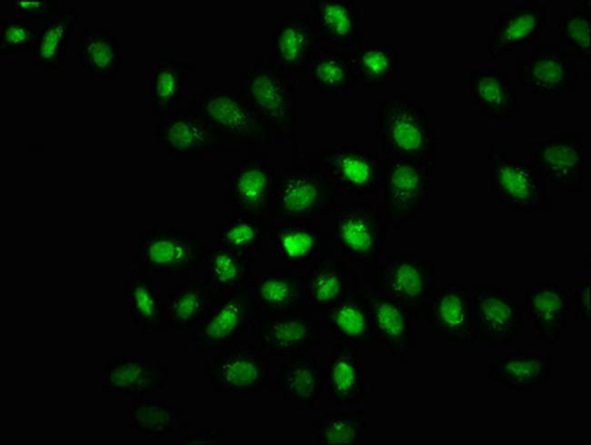 Phospho-PKR (Thr446) Antibody in Immunocytochemistry (ICC/IF)