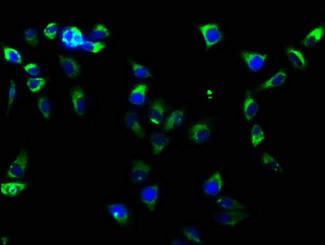 ITGB1 Antibody in Immunocytochemistry (ICC/IF)