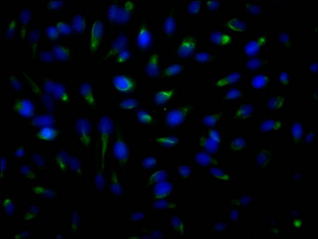 ROCK2 Antibody in Immunocytochemistry (ICC/IF)