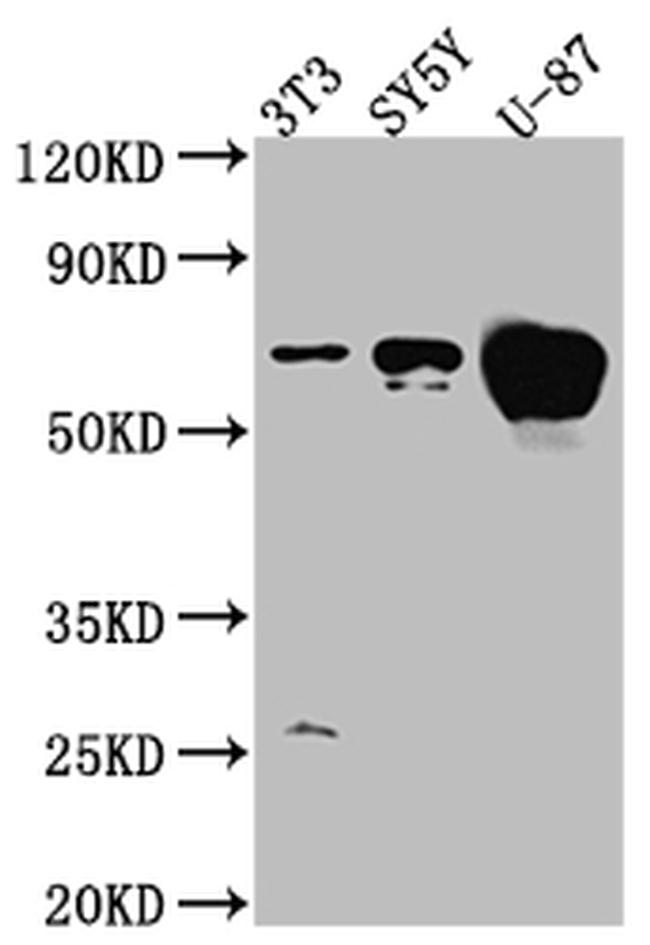 Estrogen Receptor alpha Antibody in Western Blot (WB)