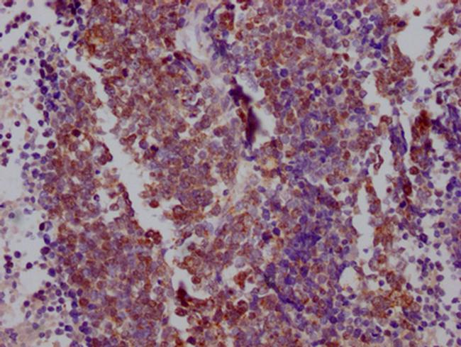 Nkx2.1 Antibody in Immunohistochemistry (Paraffin) (IHC (P))