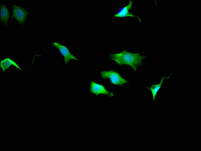 TPT1 Antibody in Immunocytochemistry (ICC/IF)