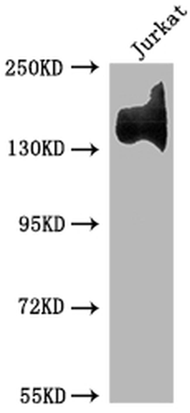 ITGA4 Antibody in Western Blot (WB)