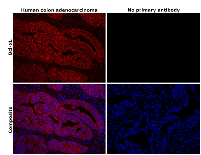 Bcl-xL Antibody in Immunohistochemistry (Paraffin) (IHC (P))