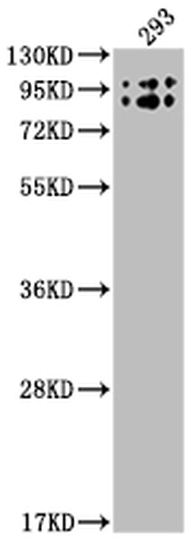 Butyrylcholinesterase Antibody in Western Blot (WB)