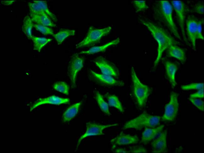 ID1 Antibody in Immunocytochemistry (ICC/IF)