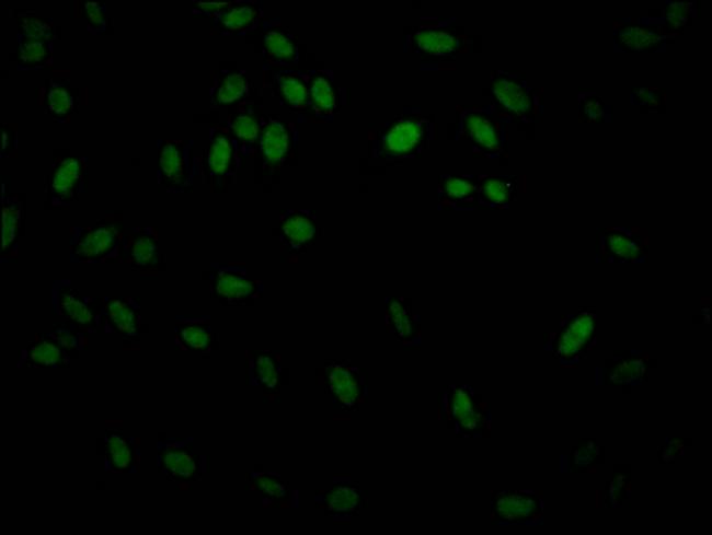 IKK beta Antibody in Immunocytochemistry (ICC/IF)