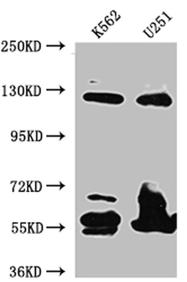 BUBR1 Antibody in Western Blot (WB)