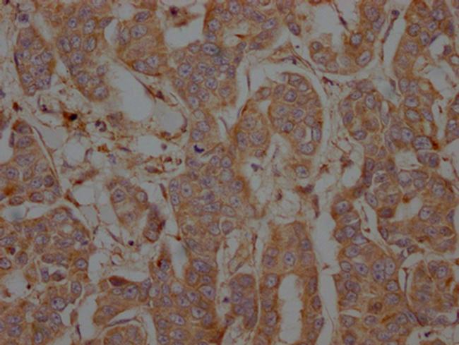 PTP1B Antibody in Immunohistochemistry (Paraffin) (IHC (P))