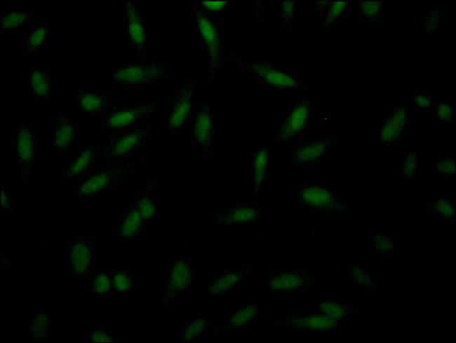 PAK1 Antibody in Immunocytochemistry (ICC/IF)