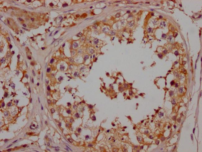 NGF Antibody in Immunohistochemistry (Paraffin) (IHC (P))