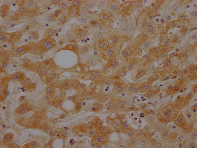 Complement C3 Antibody in Immunohistochemistry (Paraffin) (IHC (P))