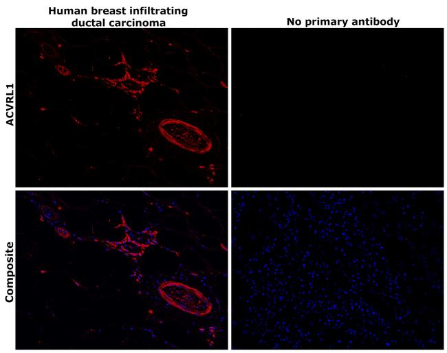 ACVRL1 Antibody in Immunohistochemistry (Paraffin) (IHC (P))