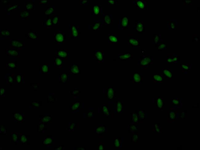 PABPN1 Antibody in Immunocytochemistry (ICC/IF)