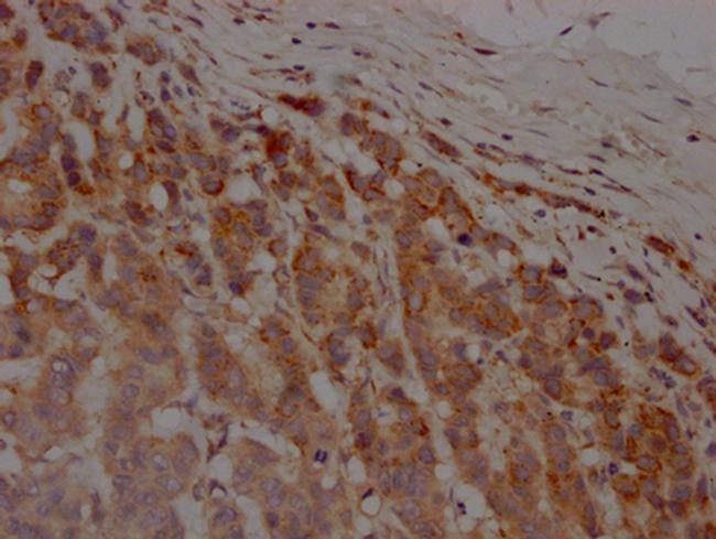 MMP12 Antibody in Immunohistochemistry (Paraffin) (IHC (P))