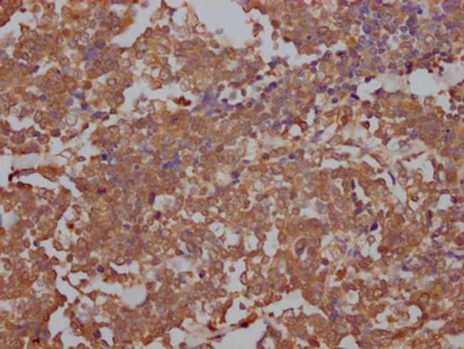 TOP2A Antibody in Immunohistochemistry (Paraffin) (IHC (P))