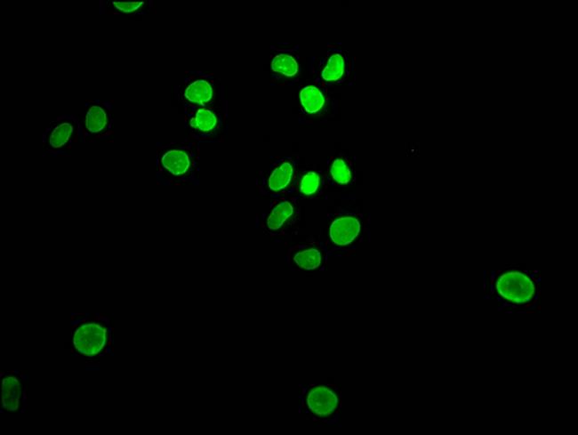 E2F1 Antibody in Immunocytochemistry (ICC/IF)