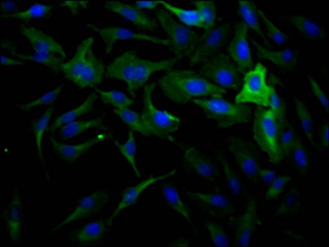 Dynamin 2 Antibody in Immunocytochemistry (ICC/IF)