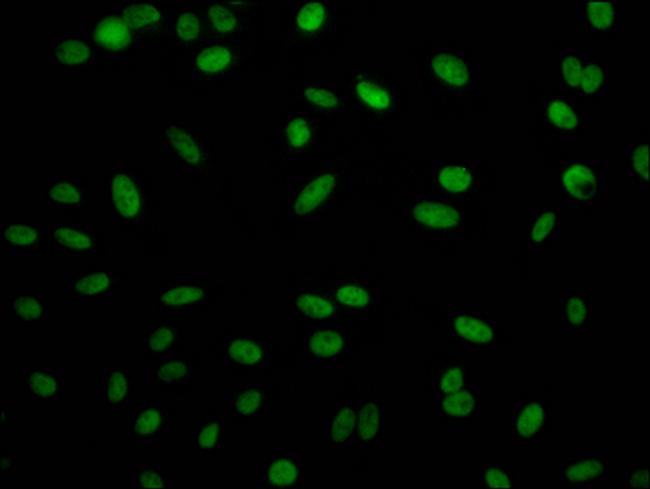 RbAp48 Antibody in Immunocytochemistry (ICC/IF)