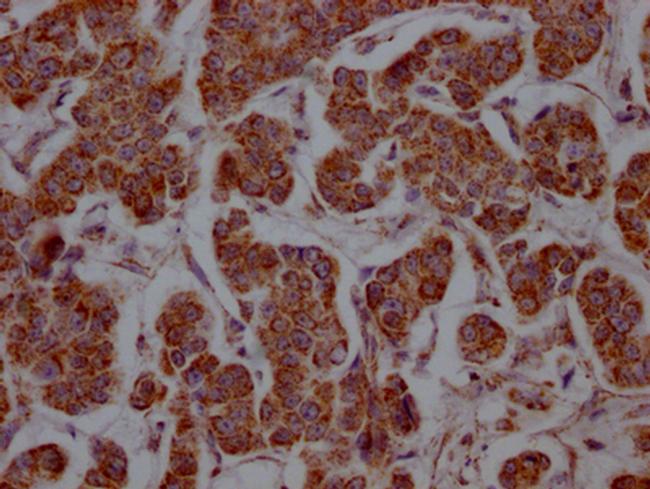 MCT1 Antibody in Immunohistochemistry (Paraffin) (IHC (P))