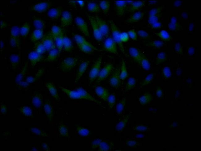 HDAC2 Antibody in Immunocytochemistry (ICC/IF)