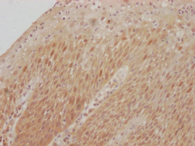 CDK2 Antibody in Immunohistochemistry (Paraffin) (IHC (P))